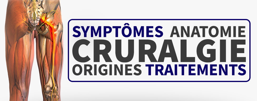 Cruralgie : Symptômes, Causes et Traitements